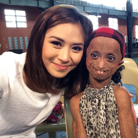 Sarah Geronimo With Progeria Stricken Rochelle Pondare