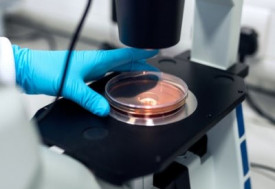 Scientist putting petri dish under microscope